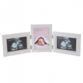 Juliana Aluminium Frame, 1st & 2nd Scan & New Born - Girl